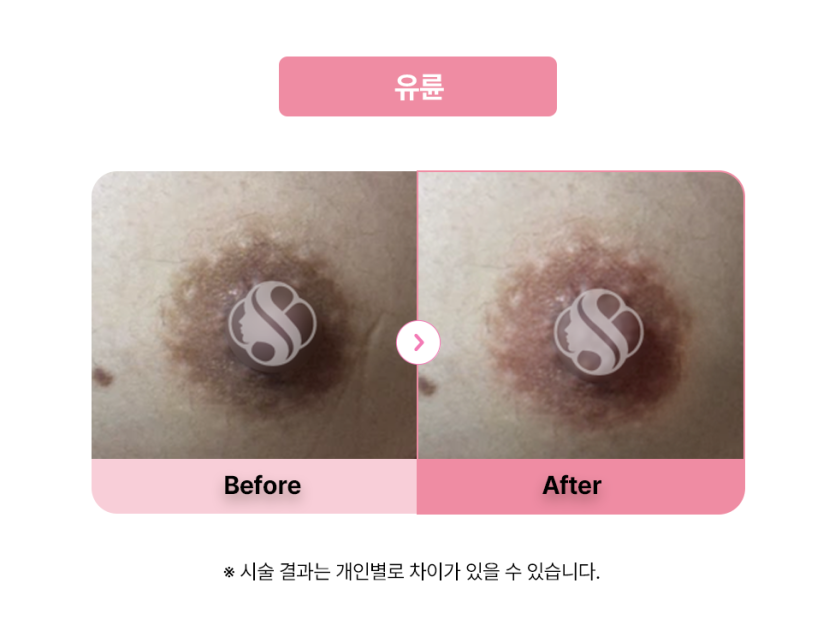 셀라닌/리핑크