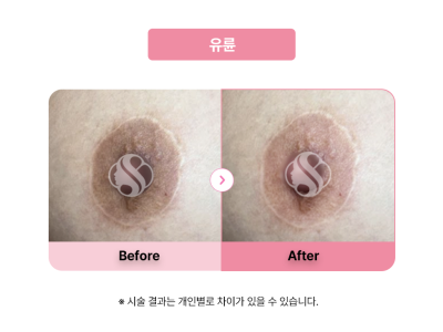 셀라닌/리핑크