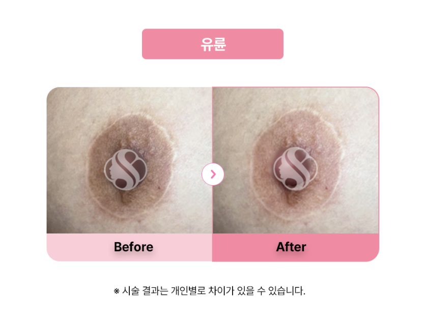셀라닌/리핑크