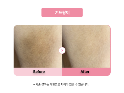 셀라닌/리핑크