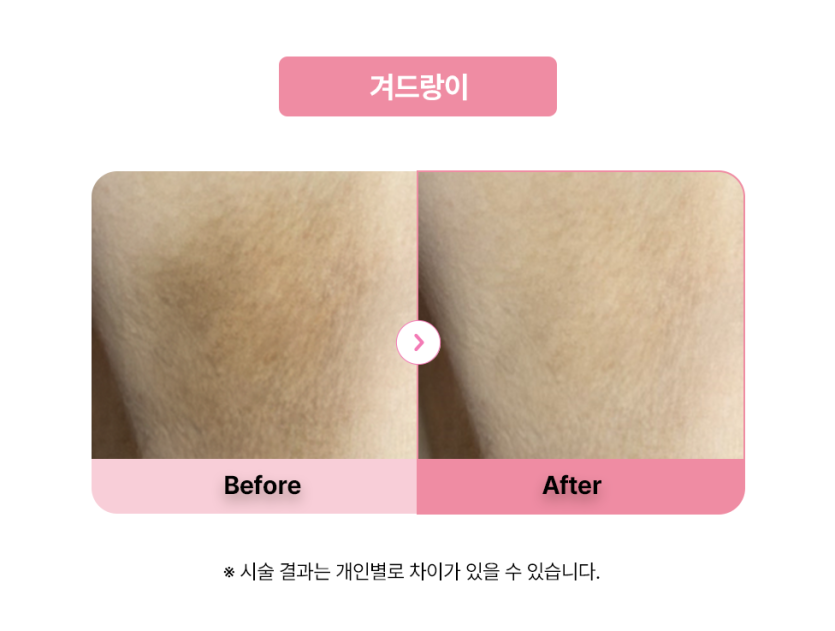 셀라닌/리핑크