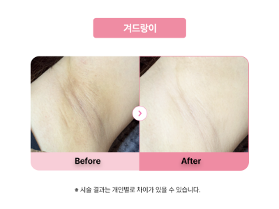 셀라닌/리핑크