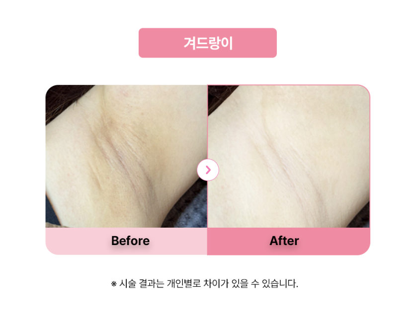 셀라닌/리핑크