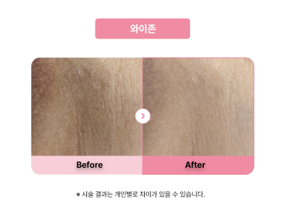 셀라닌/리핑크