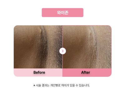셀라닌/리핑크