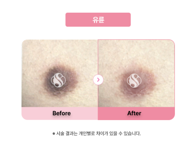 셀라닌/리핑크