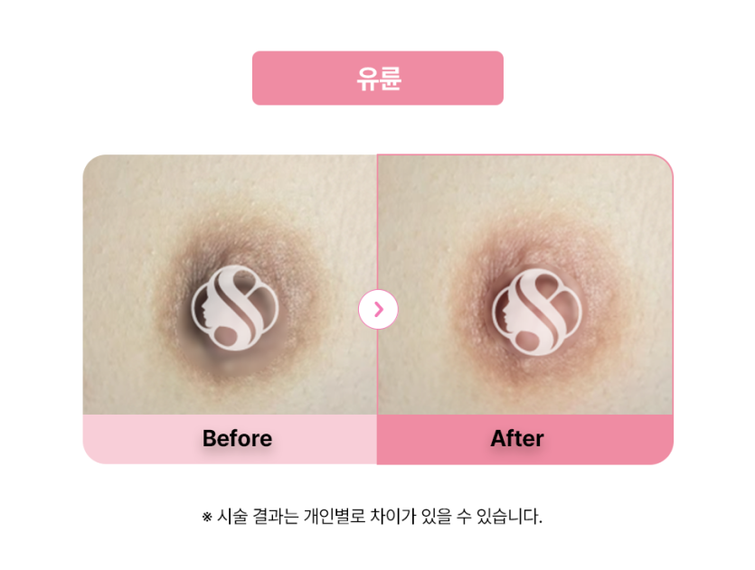 셀라닌/리핑크