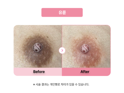셀라닌/리핑크