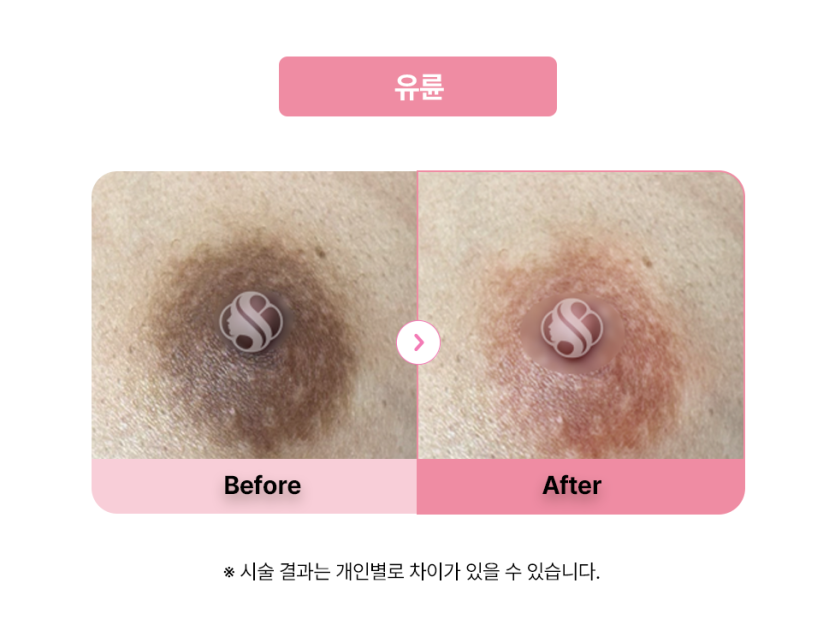 셀라닌/리핑크