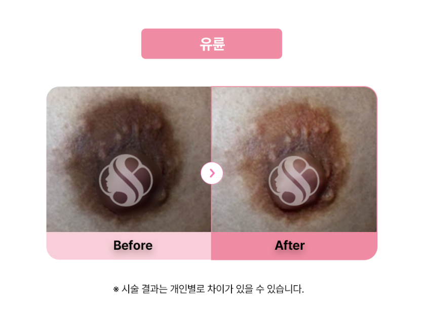 셀라닌/리핑크