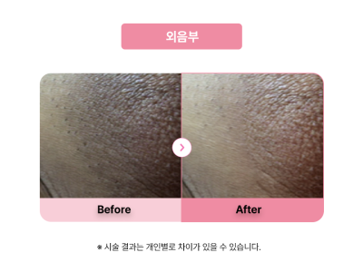 셀라닌/리핑크