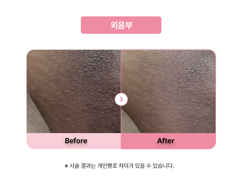 셀라닌/리핑크