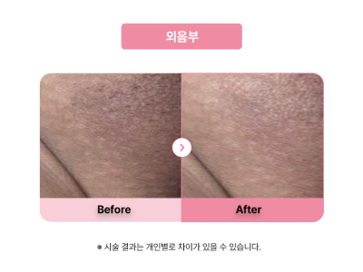 셀라닌/리핑크