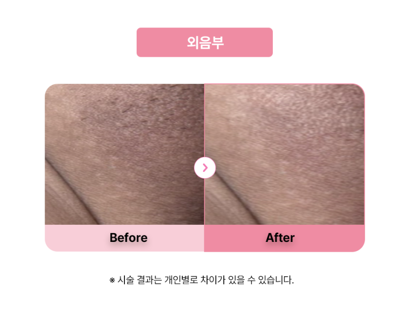 셀라닌/리핑크