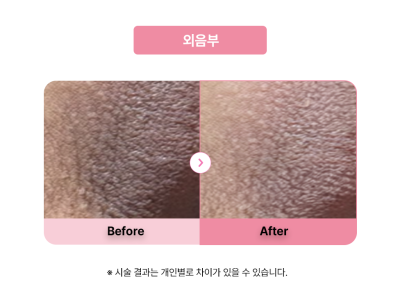 셀라닌/리핑크