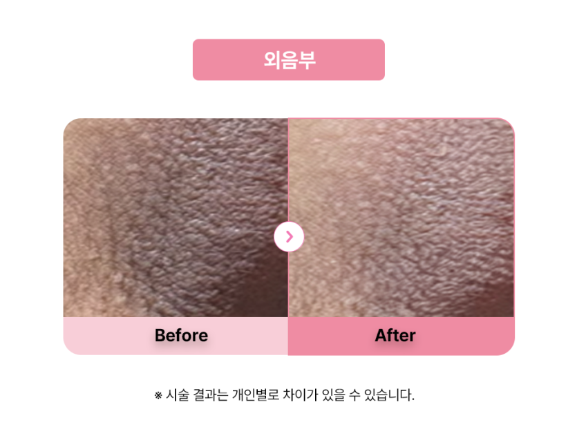 셀라닌/리핑크