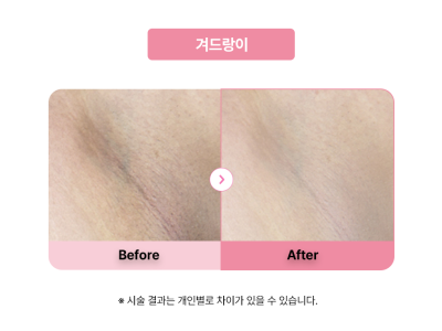 셀라닌/리핑크