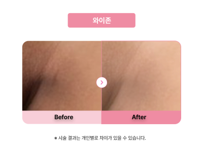 셀라닌/리핑크