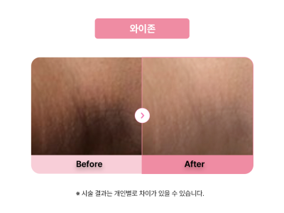 셀라닌/리핑크