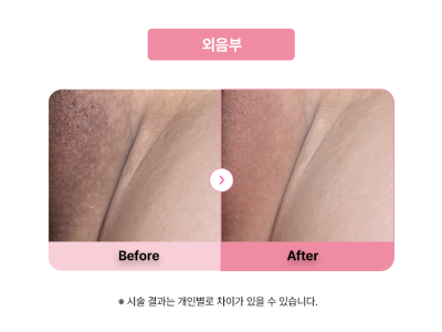 셀라닌/리핑크