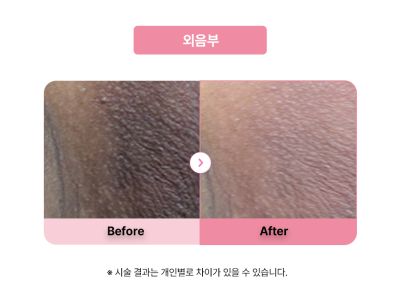 셀라닌/리핑크