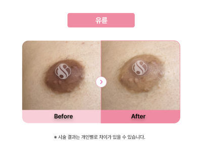 셀라닌/리핑크