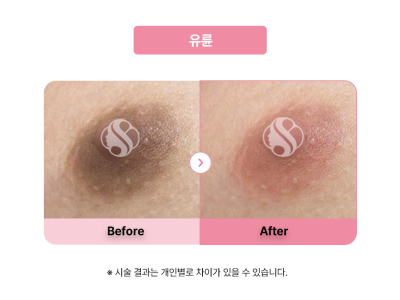 셀라닌/리핑크
