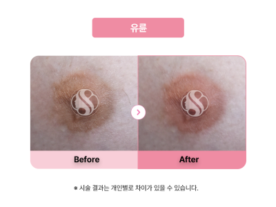 셀라닌/리핑크