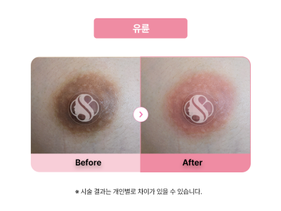 셀라닌/리핑크