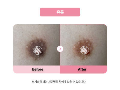 셀라닌/리핑크