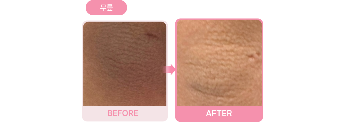 Before & After 결과 사진