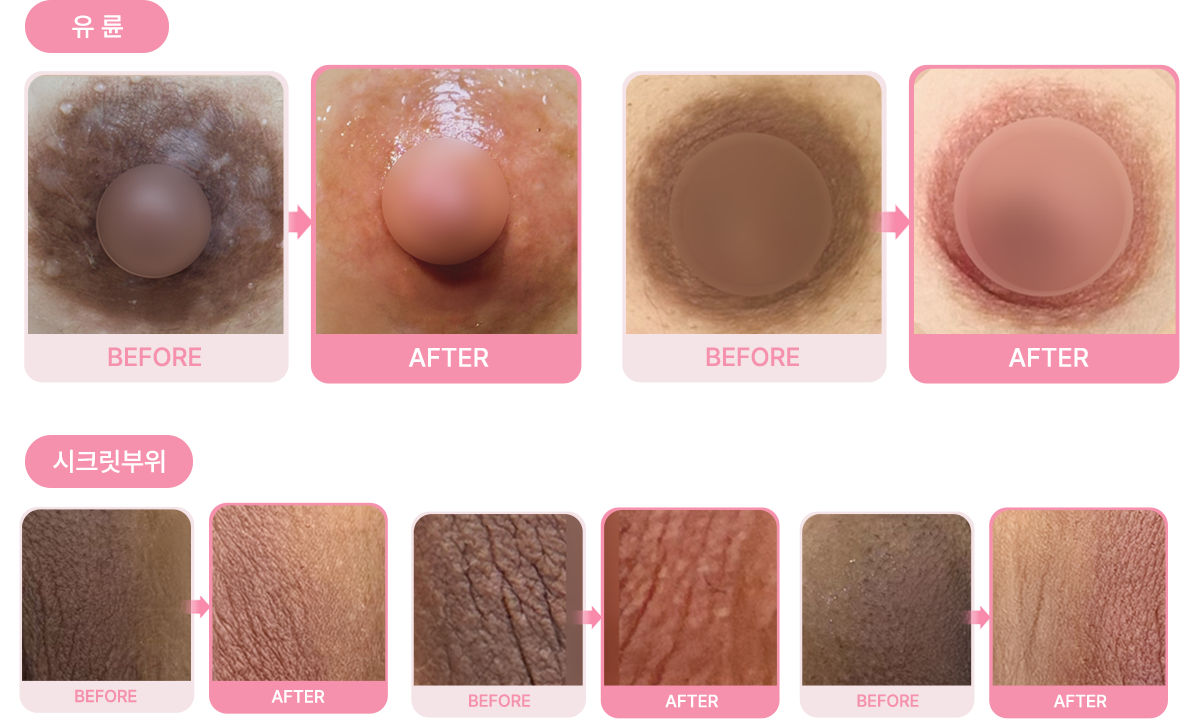 Before & After 결과 사진