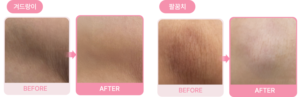 Before & After 결과 사진